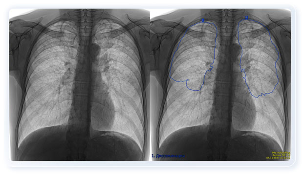 Trí tuệ nhân tạo y học - yếu tố then chốt của y tế số ở đẳng cấp toàn cầu