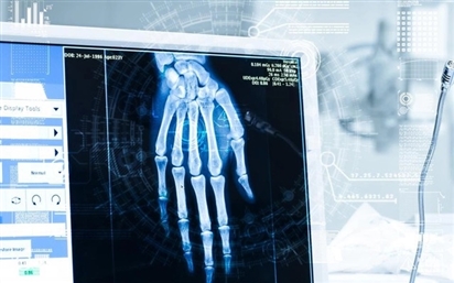 Nga ứng dụng AI trong chẩn đoán X-quang