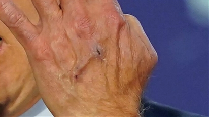 Bức ảnh bàn tay của ông Biden khiến người dùng MXH Mỹ ''sợ hãi''
