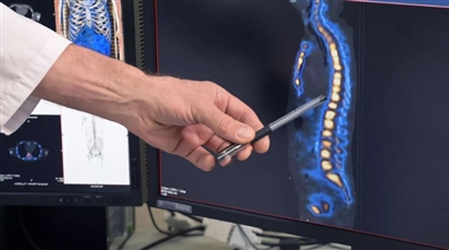 Một loại khung sinh học có khả năng phục hồi tủy sống người đã được phát triển ở Nga