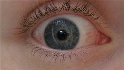 Các nhà khoa học Nga phát triển loại mắt nhân tạo có khả năng chuyển động giống như mắt thật