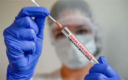 Tại sao dịch virus Hanta khác COVID-19?