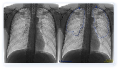 Trí tuệ nhân tạo y học - yếu tố then chốt của y tế số ở đẳng cấp toàn cầu