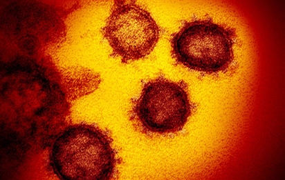 Hình ảnh của virus đáng sợ Covid-19 dưới ống kính hiển vi điện tử