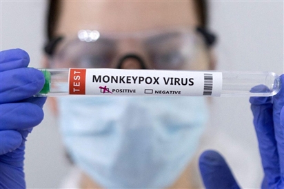Mỹ ban bố tình trạng khẩn cấp về bệnh đậu mùa khỉ