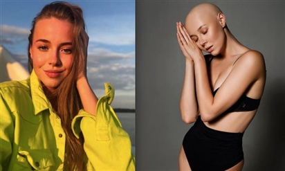 Mỹ nhân Nga từng thi Miss Grand tại Việt Nam bị ung thư vú ở tuổi 25