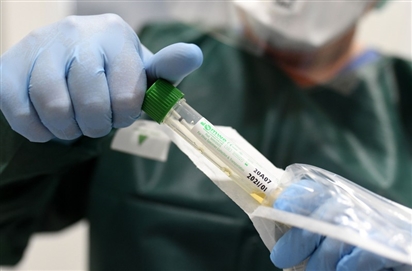 Các nhà khoa học Australia sắp thử nghiệm vaccine Covid-19 trên người