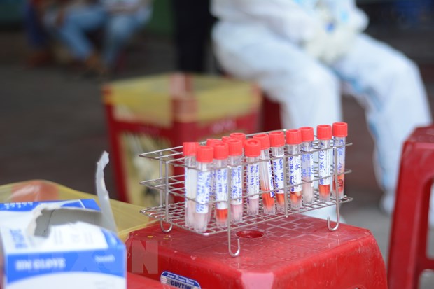Việt Nam tăng cường năng lực xét nghiệm virus SARS-CoV-2