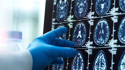 Các nhà khoa học sửng sốt vì phát hiện não người đầy vi nhựa