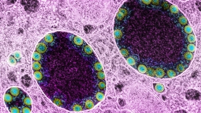 WHO: Biến thể mới XE có thể là phiên bản dễ lây lan nhất của virus SARS-CoV-2