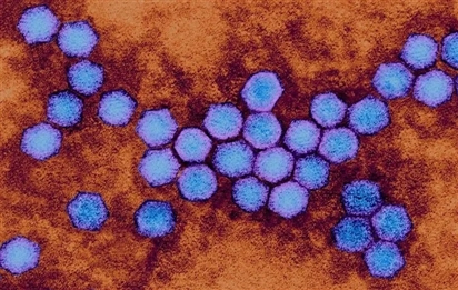 Virus bị xóa sổ gần 50 năm trước bất ngờ 'tái xuất' ở Anh